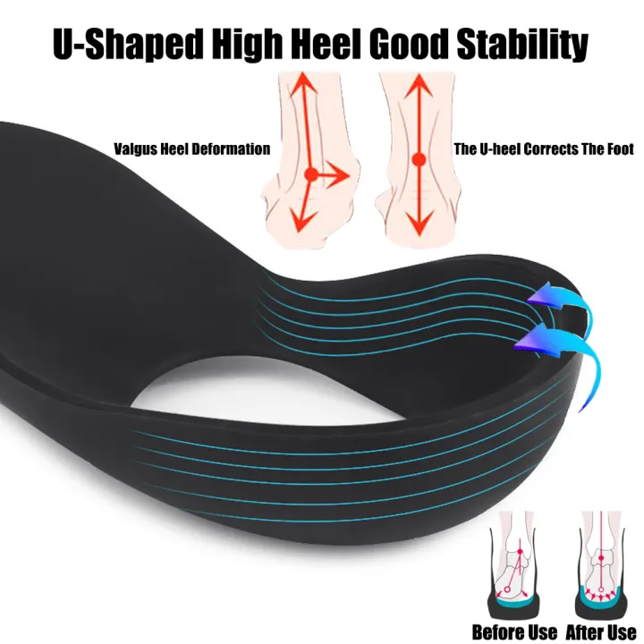 Orthotic%20Insoles%20for%20Plantar%20Fasciitis%20Pain%20Relief%20Therapy%20Flat%20Feet%20Arch%20Support%20Insoles%20for%20Shoes%20Women%20Men%20XO-Legs%20Corrector%20-%20Image%204