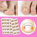 1/5pc Toe sticker Nail Strips Anti-roll Nail Glue Toe Inlay Nail Corrector Stickers Nail Patch Ingrown Toenail Correction Tool.