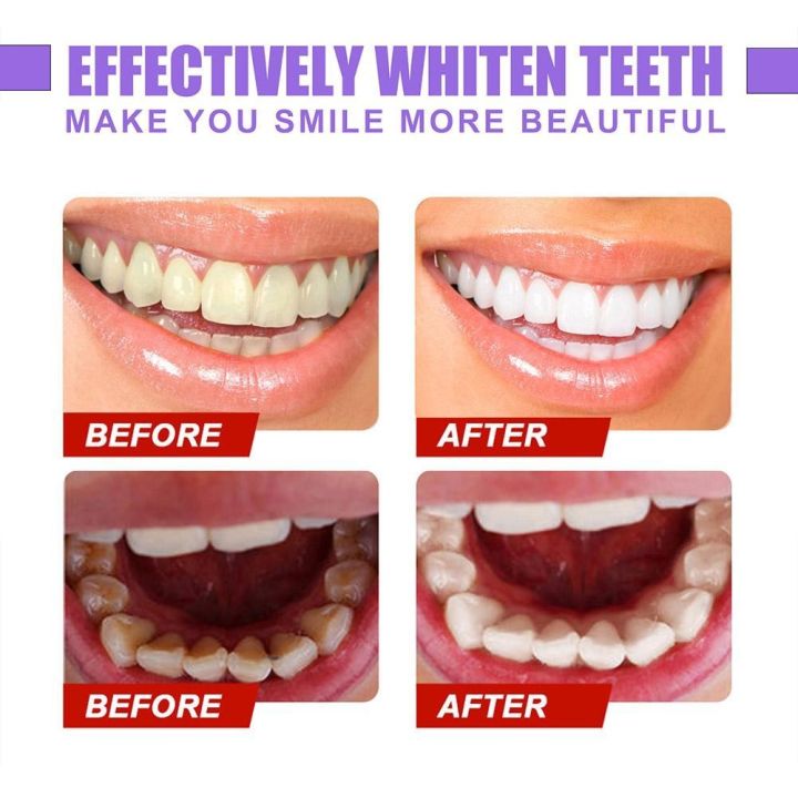 %E3%80%90The%20Edge%20of%20Beauty%E3%80%91Plaque%20Stains%20Toothpaste%20V34%20Colour%20Corrector%20Teeth%20Mouth%20Breathing%20Freshener%20Whitening%20Sensitive%20Toothpaste%20-%20Image%203