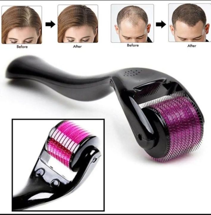 Derma Roller Micro Needle for Hair, Beard Growth and Facial Skin Therapy (All Sizes)