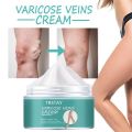 Varicocele Cream Relieving Limb Swelling, Soothing, and Moisturizing Skin. 