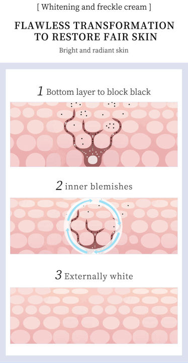 YOUBUY%20Whitening%20and%20Freckle%20Removing%20Cream%20-%20Image%203