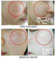 Beaute Melasma-X 3D Whitening Clinic Renewal Cream. 