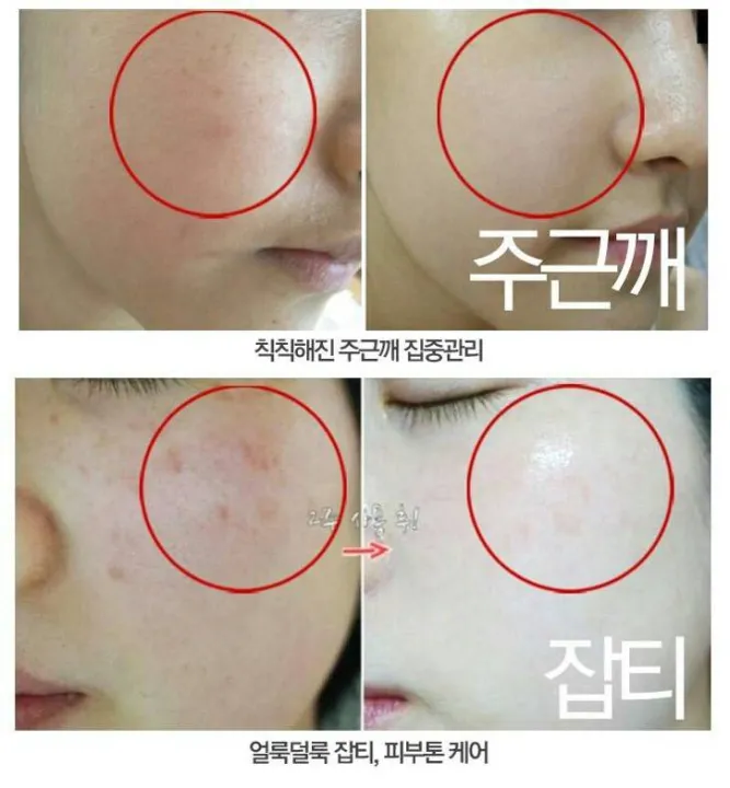 Beaute%20Melasma-X%203D%20Whitening%20Clinic%20Renewal%20Cream%20-%20Image%202