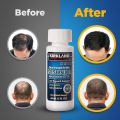 Kirkland Minoxidil 5% for Beard & Hair Growth. 