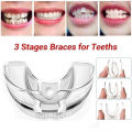 Dental Orthodontic Teeth Corrector Braces Retainer Straighten Tools Tooth Care Fullhouse. 