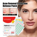 200Pcs Invisible Acne Removal Pimple Patch Beauty Acne Tool Colorful Pimple Acne Mask Concealer Face Spot Scar Care Sticker. 