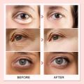 AUQUEST Dark Circles Remover Eye Cream Peptide Anti-Puffiness Eye Bags Wrinkle Cream Moisturizing Lifting Firming Eye Skin Care JokeT. 