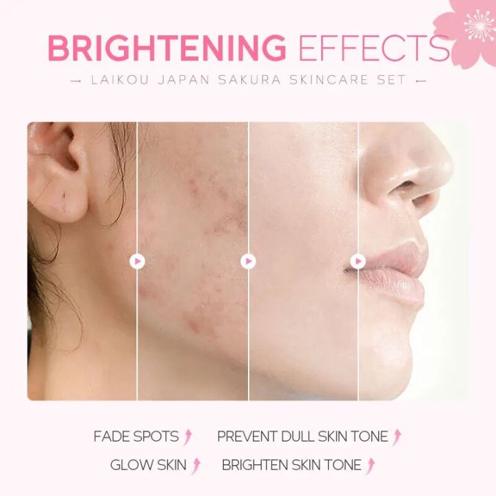 5-piece%20Gift%20Box%20Cherry%20Blossom%20Sakura%20Skin%20Care%20Set%20Collagen%20Eye%20Cream%20Serum%20Facial%20Cleanser%20Toner%20Facial%20Cream%20Beauty%20Makeup%20-%20Image%202