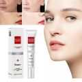 YOUBUY Whitening Blemish 20g Best Selling Whitening Moisturizing Anti Aging Freckle Removing Face Cream. 