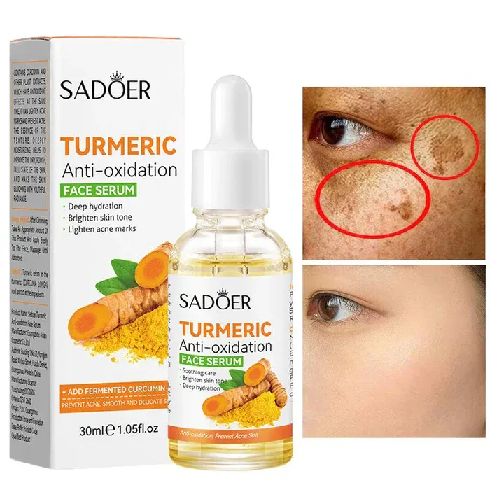 %E3%80%BD%EF%B8%8F%20SADOER%20Turmeric%20Anti%20Oxidation%20Face%20Serum%2030ml%20-%20Image%202