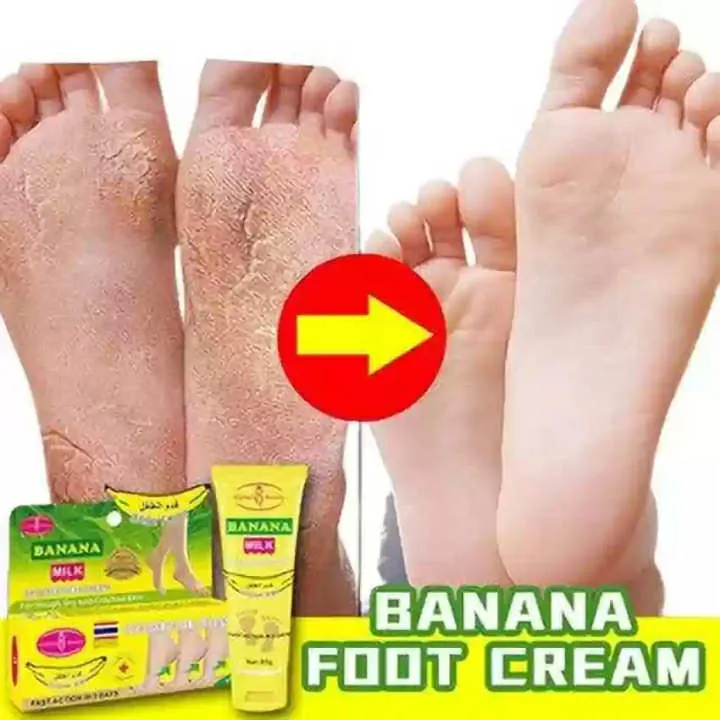 Picture%20of%20AICHUN%20BEAUTY%2080gm%20Cracked%20Heel%20Cream%20Foot%20Care%20Banana%20Milk%20Cream%20Rough%20Dry%20Skin%20Baby%20Foot%20Picture%20of%20AICHUN%20BEAUTY%2080gm%20Cracked%20Heel%20Cream%20Foot%20Care%20Banana%20Milk%20Cream%20Rough%20Dry%20Skin%20Baby%20Foot%20AICHUN%20BEAUTY%2080gm%20Cracked%20Heel%20Cream%20Foot%20Care%20Ban%20-%20Image%203