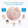 Aichun Beauty Anti Stretch Mark Scar Removal Cream. 