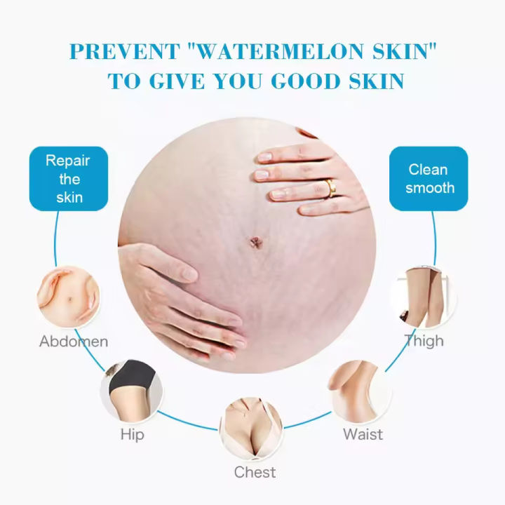 Aichun%20Beauty%20Anti%20Stretch%20Mark%20Scar%20Removal%20Cream%20-%20Image%205