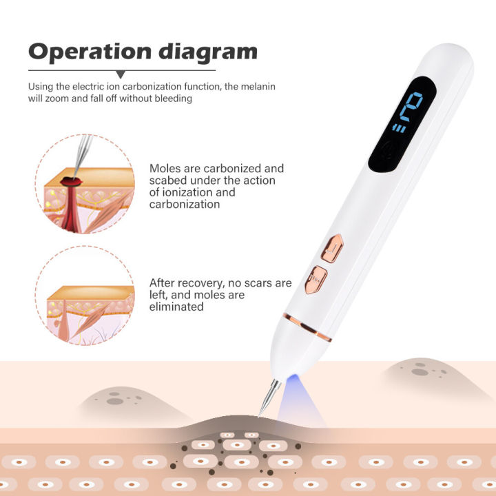 LCD%20Plasma%20Removal%20Pen%20Face%20Wart%20Freckle%20Remover%20Machine%20Mole%20Dark%20Spot%20Skin%20Tag%20Removal%209%20Level%20USB%20Charge%20Beauty%20Salon%20-%20Image%207