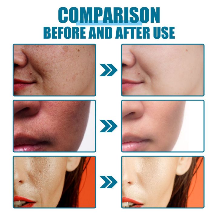 Bioaqua%20Rice%20Face%20Sleeping%20Mask%20Moisturizing%20Lightening%20Face%20Lifting%20Smooth%20Centella%20Facial%20Jelly%20Masks%20Korean%20Cosmetics4ML*5pcs%20-%20Image%203