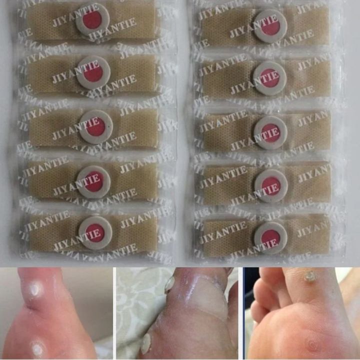 【Innovative】 100Pcs Foot Care Medical Plaster Sticker Protector Sticker Foot Corn Removal Pads Warts Thorn Remover Feet Foot Care Tools