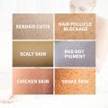 Keratosis Pilaris Removal Cream Chicken Skin Folliculities Treatment Repair Whitening Moisturizing Smooth Body Lotion. 