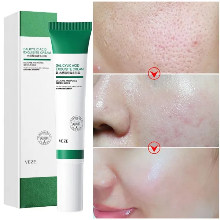 Salicylic%20Acid%20Pores%20Refining%20Cream%20Shrink%20Pore%20Improve%20Acne%20Blackheads%20Oil%20Control%20Cream%20Moisturizing%20Face%20Skin%20Care%2020ml%20Vnce%20Lncei%20-%20Image%203