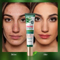 SADOER Tea Tree Oil Control Anti-Acnes Gel- 20g. 