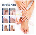 Repair Nail Fungus Treatment Serum Toe Fungal Repair Products Hand Foot Care Removal Gel Anti Infection Onychomycosis Paronychia.
