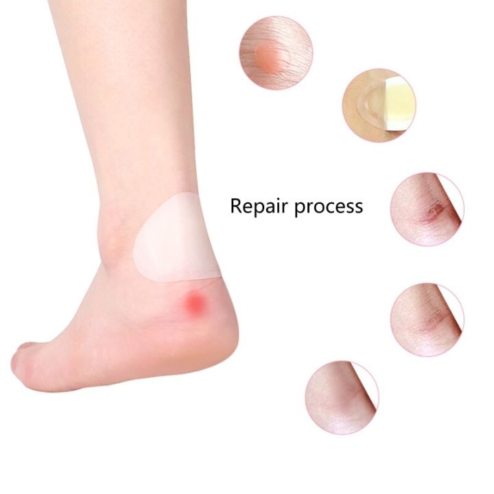 1pc%20Blister%20Bandages,Blister%20Gel%20Pads%20Waterproof%20Hydrocolloid%20Gel%20Blister%20Cushions,Adhesive%20Foot%20Blister%20Patch%20for%20Feet,%20Toe%20-%20Image%203