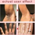 Whitening Cream for Dark Skin Armpit Intimate Areas Brighten Lotion Lightening Underarm Dull Body Skin Care Private Parts Bleach. 