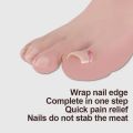 10pcs Ingrown Toenail Correction Tool Ingrown Toe Nail Treatment Elastic Patch Sticker Straightening Clip Brace Pedicure Tool.