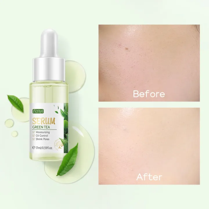 Fenyi%20Green%20Tea%20Cream/Eye%20Crem/Serum%20Combo%20-%20Image%205