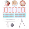 Ingrown Toenail Corrector Tools Set Pedicure Recover Embed Toe Nail Treatment Professional Ingrown Toenail Correction Foot Care MIRRORRR. 