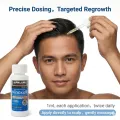 Kirkland Minoxidil 5% Topical Solution Extra Strength Hair Regrowth Treatment for Men Hair & Beard Drop + Derma Roller Free - (1 month supply) - MNXMC. 