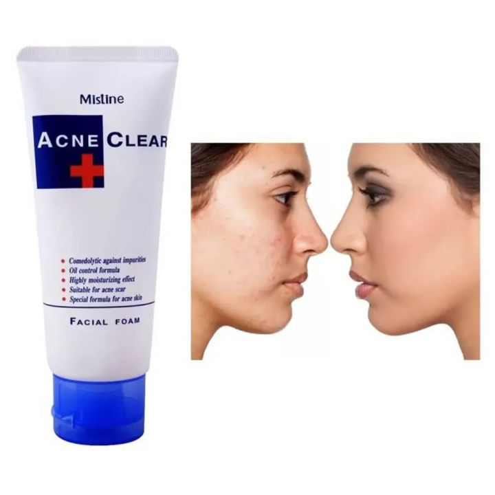 Mistine Acne Clear Facial Foam 85g