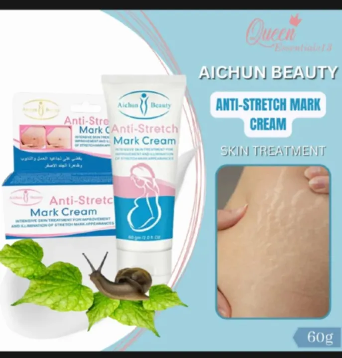 Aichun%20Beauty%20Anti-Stretch%20Marks%20Cream%20%7C%20Stretch%20Marks%20Removal%20Cream%20-%20Image%203