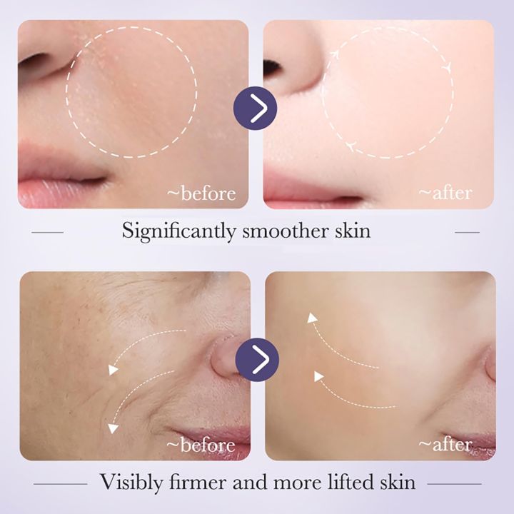 BIOAQUA%20Facial%20Retinol%20Serum%2030ml%20Anti-Wrinkle%20Tender%20Skin%208.5%25%20Retinol%205%25%20Hyaluronic%20Acid%20Moisturizing%20Essence%20-%20Image%206