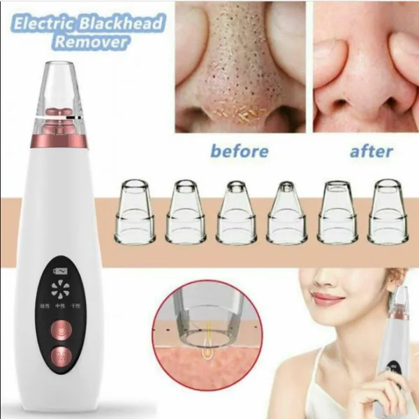 Powerful%20pore%20vacuum-%20featuring%206%20suction%20heads-%20effectively%20reduces%20blackheads-%20Suitable%20for%20both%20women%20and%20men%20-%20Image%204