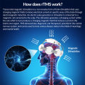 Dawfek rTMS for Anxiety Home Remedy Anxiety Depression Management of Bipolar I Disorder Transmagnetic Stimulation Machine rTMS.