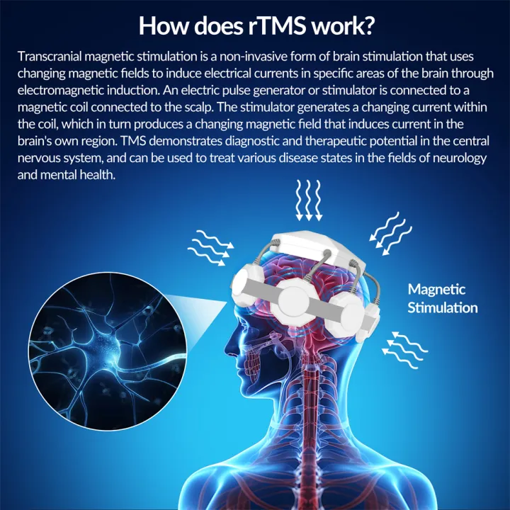 Dawfek%20rTMS%20for%20Anxiety%20Home%20Remedy%20Anxiety%20Depression%20Management%20of%20Bipolar%20I%20Disorder%20Transmagnetic%20Stimulation%20Machine%20rTMS%20-%20Image%202