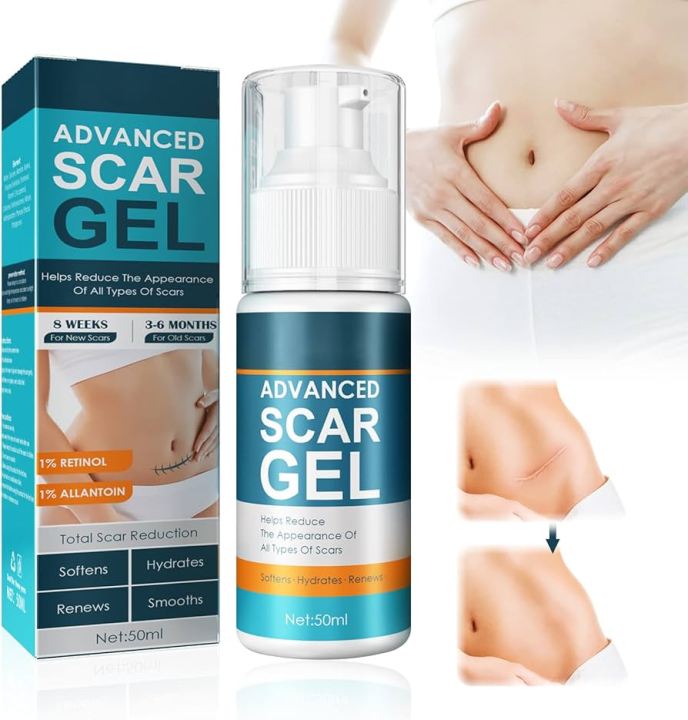 Jaysuing Advanced Scar Gel, Scar Removal for Surgical Scars, Acne Scar Removal Cream-50gm
