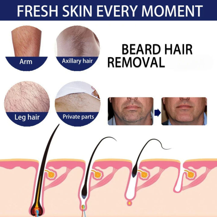 Men's%20Beard%20Hair%20Removal%20Cream%20Permanent%20Hair%20Growth%20Removal%20Inhibitor%20Spray%20Gentle%20body%20Beard%20Armpit%20Depilatory%20Care%20Cream%20-%20Image%203