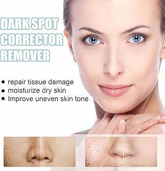 Skin%20Sunrise%20Night%20Cream%2020grm%20-%20Image%204