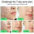 Salicylic Acid Acne Treatment Cream Repair Pimple Spots Deep Cleaning Pore Shrinking Anti-acne Oil Control Moisturizer Skin Care. 