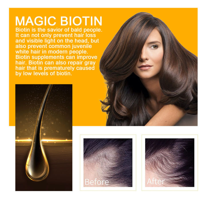 Fast%20Hair%20Growth%20Products%20Biotin%20Serum%20Conditioner%20Anti%20Hair%20Loss%20Fast%20Regrowth%20Thicken%20Scalp%20Treatment%20Nourishing%20Hair%20Care%20Oil%20-%20Image%203