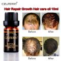 CZLMI Fast Powerful Hair Growth Essence Products Essential Oil Liquid Treatment Preventing Hair Loss Hair Care Andrea 10ml.