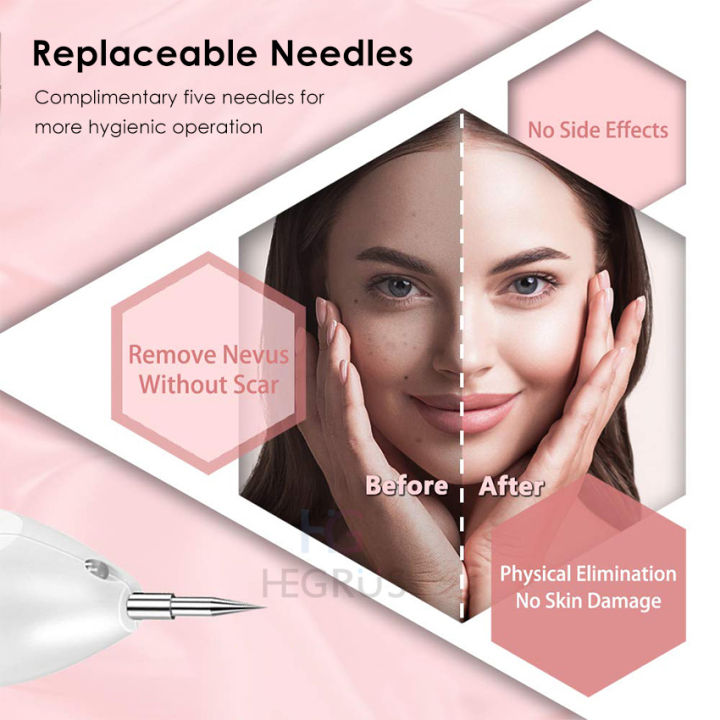 HEGRUS%20Face%20Mole%20Removal%20Pen%20Spots%20Tattoo%20Freckle%20Removal%20Pen%20LED%20Lighting%20Sweep%20Spot%20Mole%20Removing%20Dark%20Spot%20Remover%20Skin%20Care%209%20Adjustable%20Modes%20Laser%20Mole%20Pen%20-%20Image%207