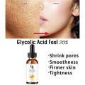 70% Glycolic Acid Chemical Peel Anti-Aging Brightening Smoothing Fine Lines Skin Pigmentation Acne Scars 30ml. 