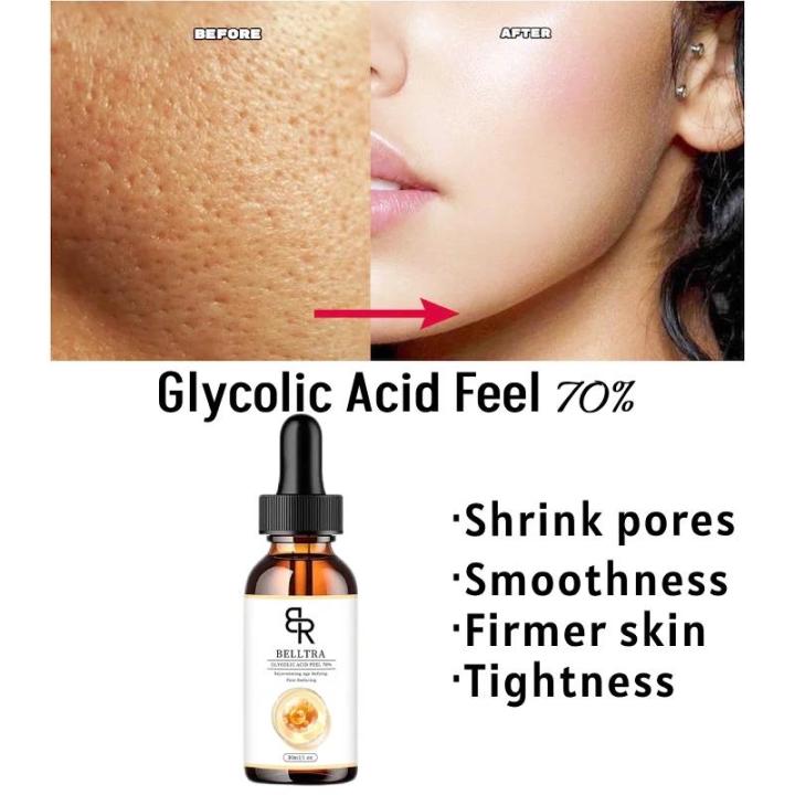 70%25%20Glycolic%20Acid%20Chemical%20Peel%20Anti-Aging%20Brightening%20Smoothing%20Fine%20Lines%20Skin%20Pigmentation%20Acne%20Scars%2030ml%20-%20Image%204