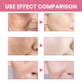 Facial Cleansing Powder Oil Control Fade Dark Spot Exfoliation Shrink Pores Remove Blackheads Moisturize Whitening Face Cleanser.