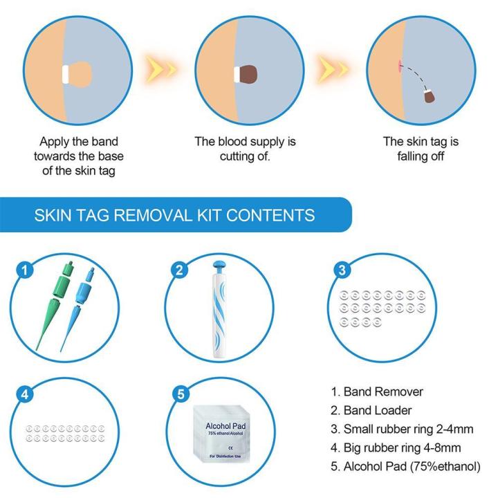2%20IN%201%20Auto%20Micro%20Skin%20Tag%20Remover%20Pen%20Standard%20Micro%20Skin%20Tag%20Removal%20Kit%20-%20Image%204