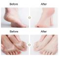 Exfoliating Foot Peeling Mask1 Pair/2PCS Pedicure Socks Scrub For Repair Dead Skin Remove Peel Off Care Korean Cosmetic 40Ml. 