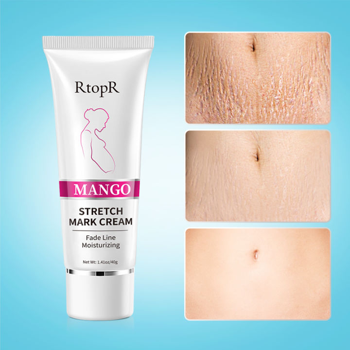 RtopR%20Mango%20Stretch%20Mark%20Cream%20Stretch%20Mark%20Repair%20Maternity%20Repair%20Cream%20Anti-Aging%20Anti-Wrinkle%20Firming%20Whitening%20Body%20Cream%2040g%20-%20Image%203